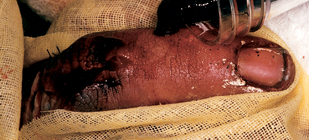 Case1_1