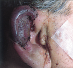 Case2_24hours
