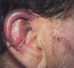 Case2_6days