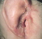 Case3_2months